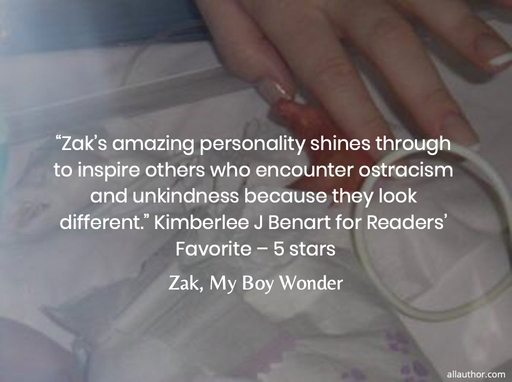 zaks amazing personality shines through to inspire others who encounter ostracism...