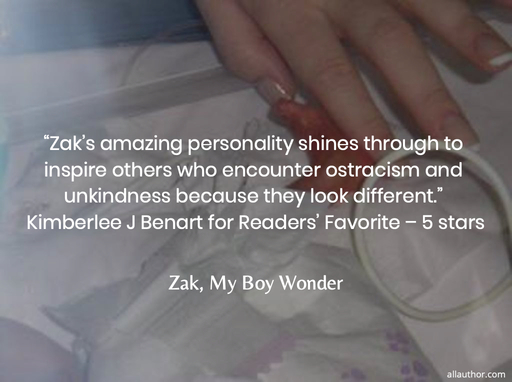 zaks amazing personality shines through to inspire others who encounter ostracism...